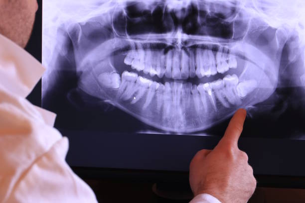 Best Emergency Cosmetic Dentistry in Chattanooga, TN