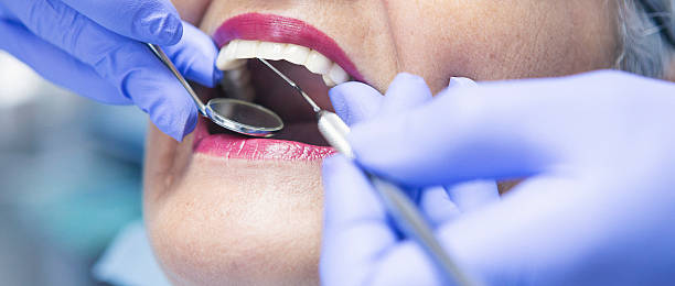 Best Emergency Dental Services for Seniors in Chattanooga, TN